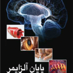 کتاب پایان آلزایمر اثر توماس جی. لوئیس ، کلمنت ترمپ 1404