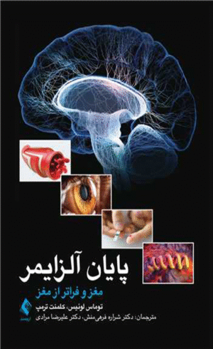 کتاب پایان آلزایمر اثر توماس جی. لوئیس ، کلمنت ترمپ 1404